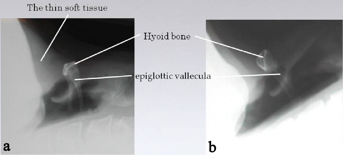 thyroid cartilage x ray